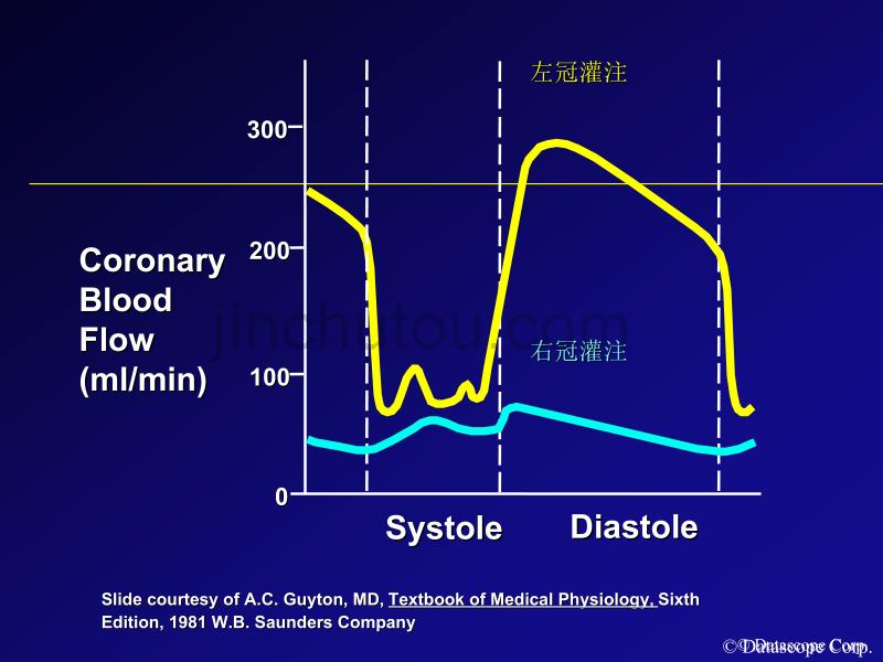 主动脉内球囊反搏泵的临床使用_第2页