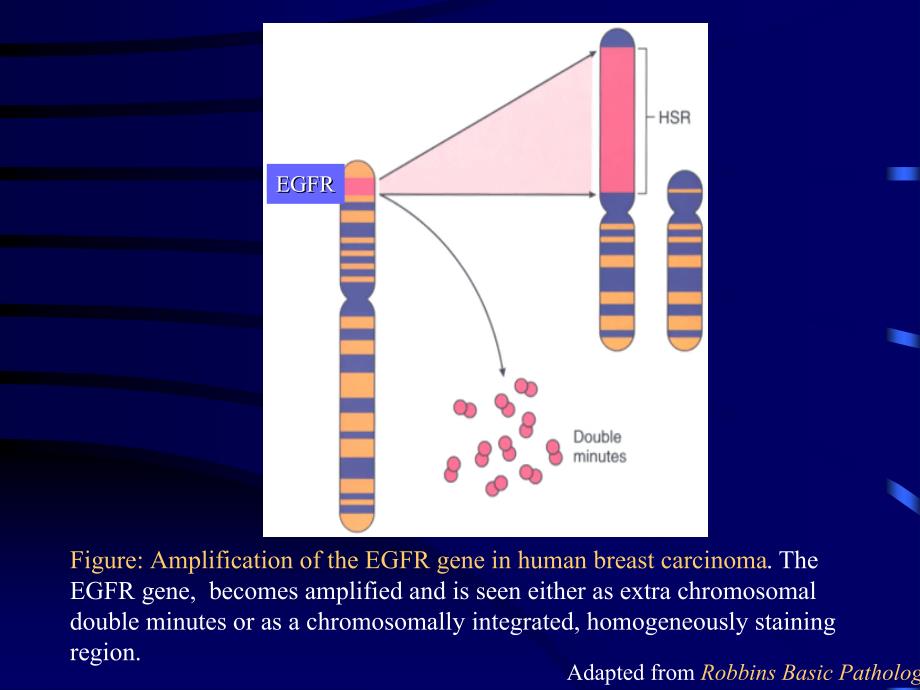 乳腺癌的分子生物学进展（二）_第1页