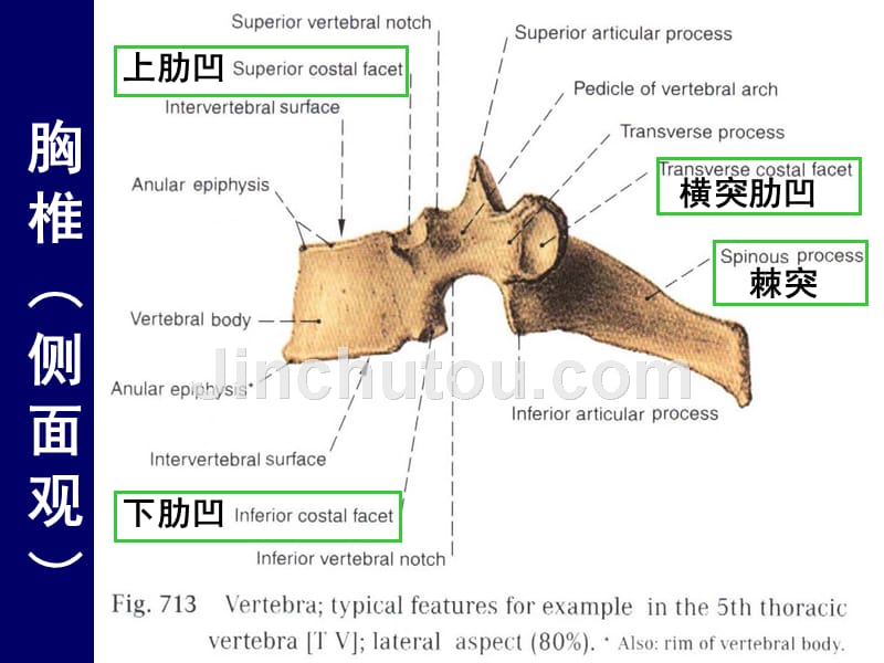 人体断层解剖学、脊柱区胸段解剖_第3页