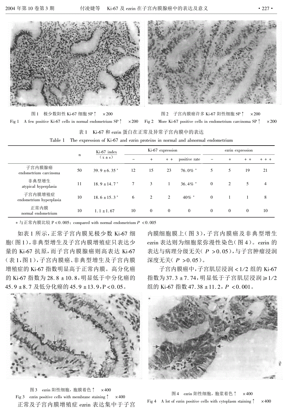 ；=及&#.在子宫内膜腺癌中的表达及意义_第3页