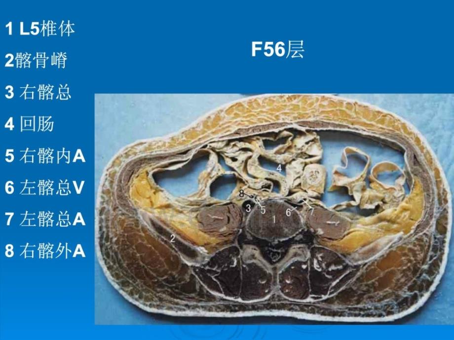 断层解剖学－女性盆部 昆明医学院人体解剖学教研室_第3页