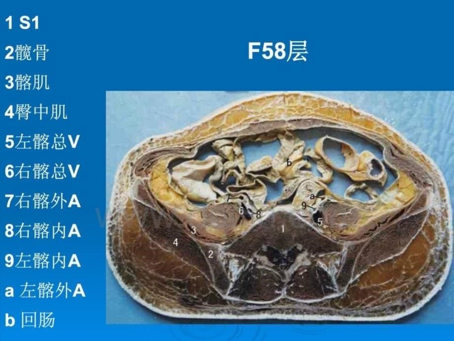 断层解剖学－女性盆部 昆明医学院人体解剖学教研室_第5页