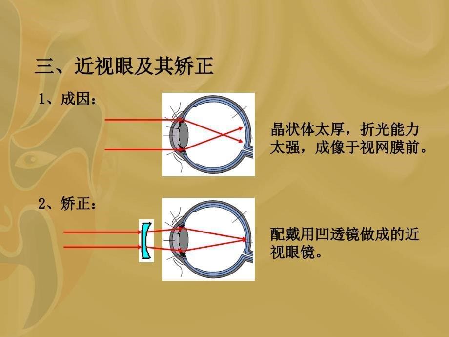 物理34《眼睛和眼镜》课件2(人教版八年级上)_图文_第5页