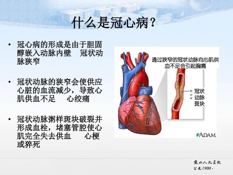 冠心病的健康指导_图文_第5页