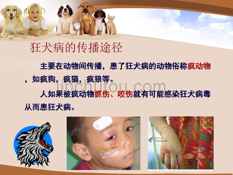 犬咬伤的急救常识与预防_第4页