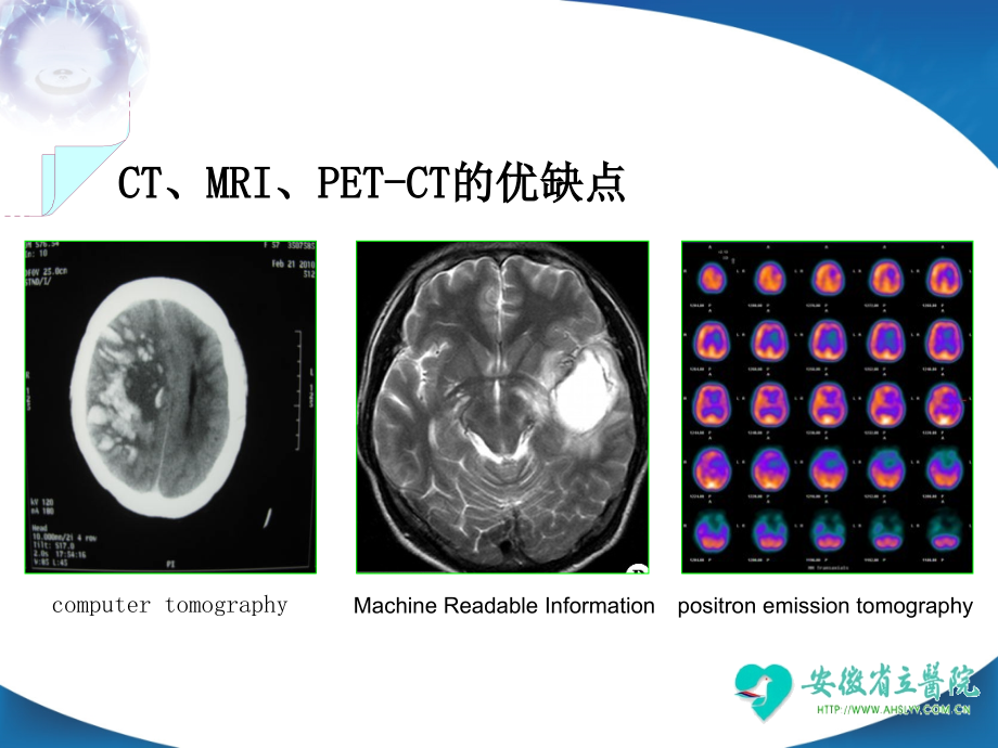 重型颅脑损伤的监护与治疗_第4页