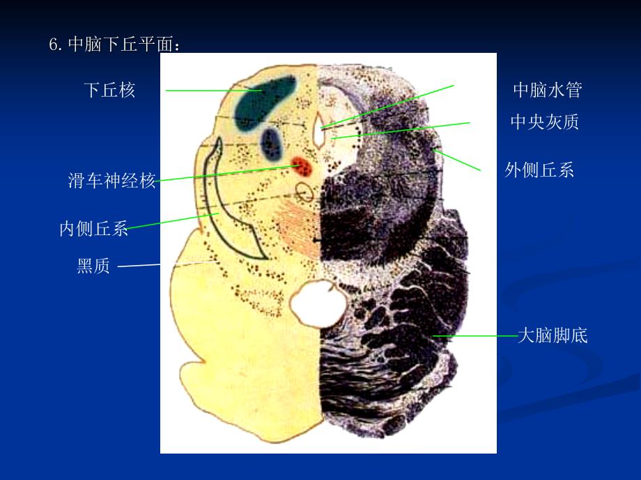 脑干综合症brainstem_syndrom_第3页