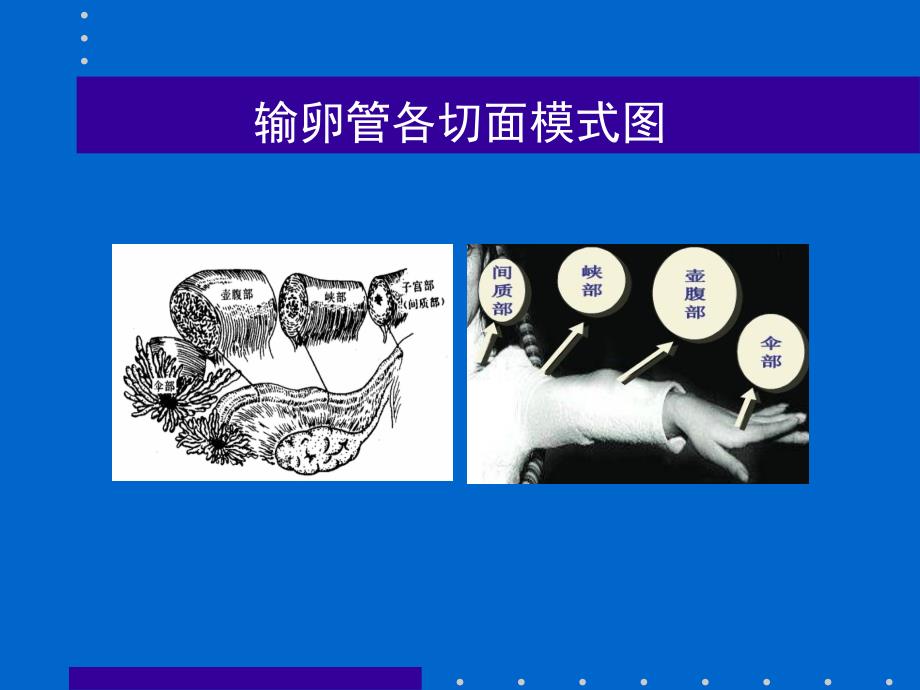 异位妊娠的超声诊断.ppt_第3页