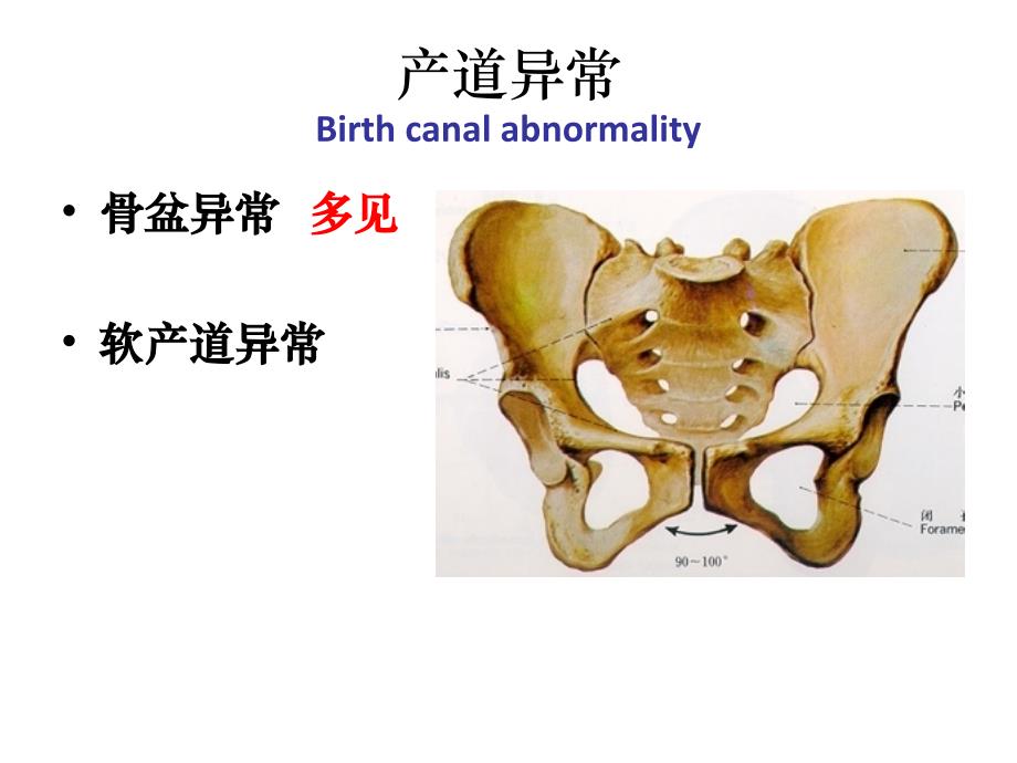 异常分娩产道异常 ppt课件_第1页