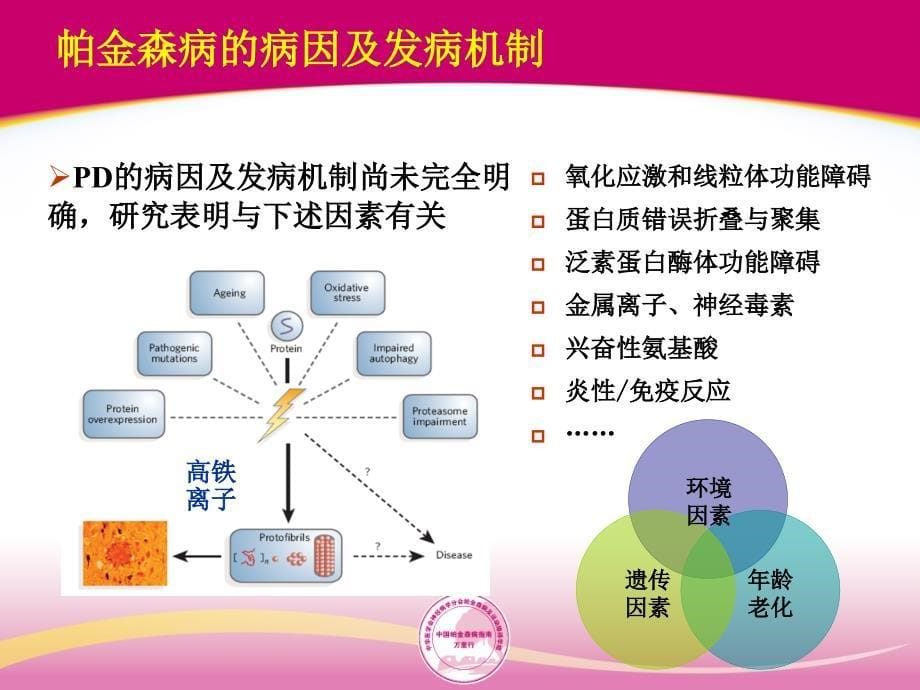 帕金森病的诊断及鉴别诊断_第5页