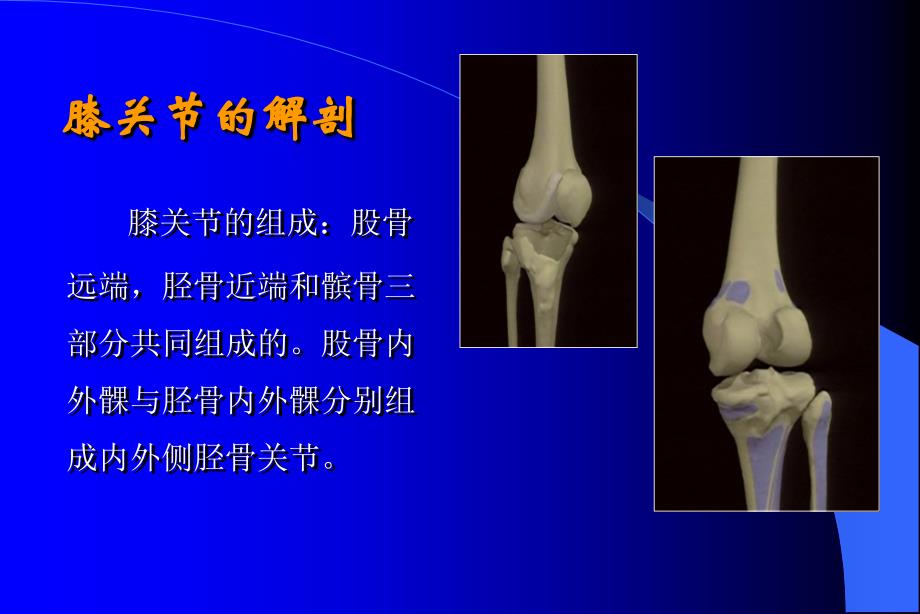 人工膝关节置换护理查房-改4_图文_第3页