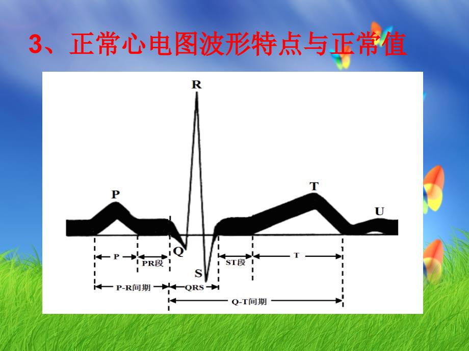 正常心电图及心律失常心电图的判读_第4页