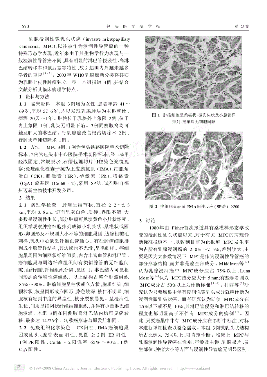 乳腺浸润性微乳头状癌临床病理学观察_第2页