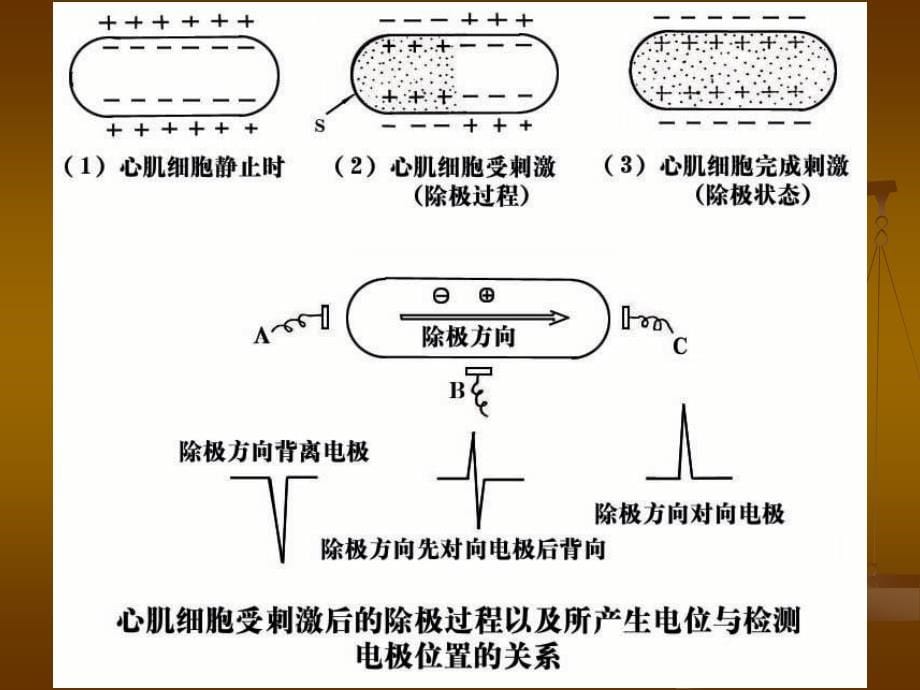 讲课心电图基本知识PPT课件_第5页