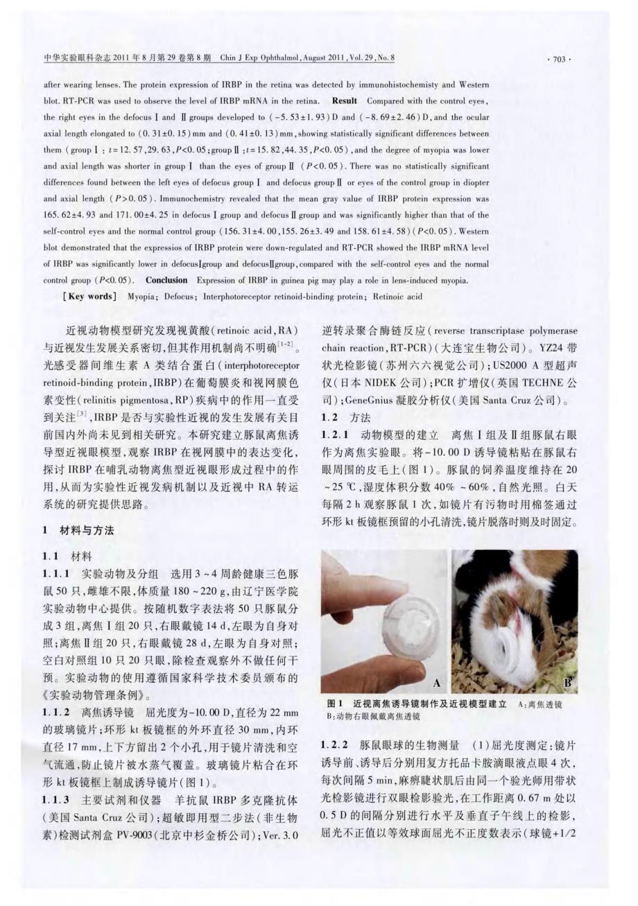 光感受器间维生素A类结合蛋白在豚鼠离焦诱导型近视眼中的表达_第2页