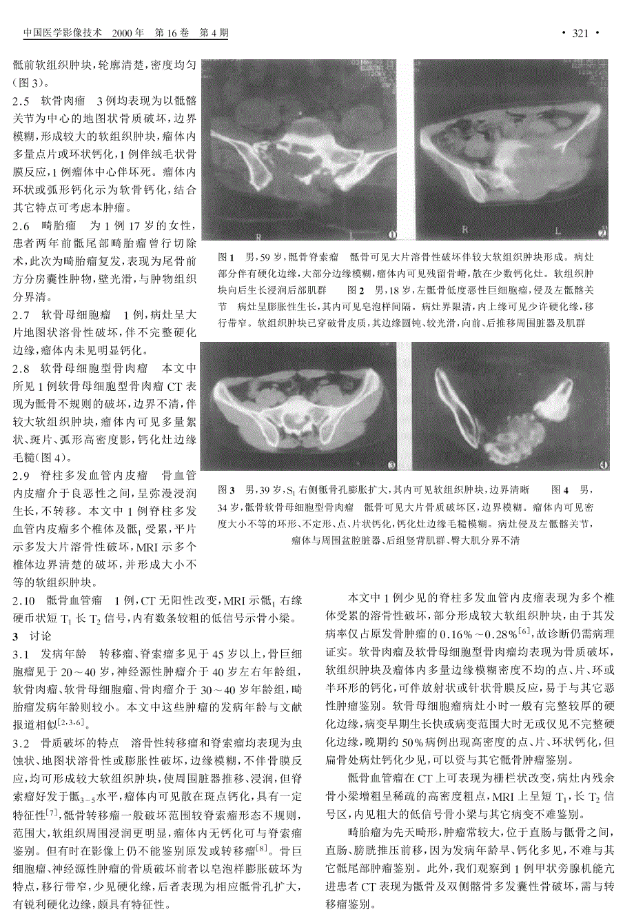 骶骨肿瘤的CT影像表现_第2页