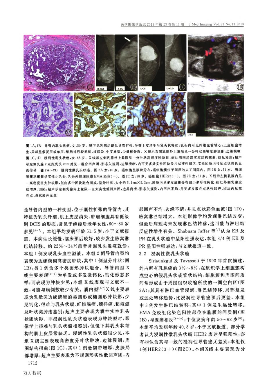 少见类型乳腺癌的影像、临床、病理及免疫组化分析_第3页