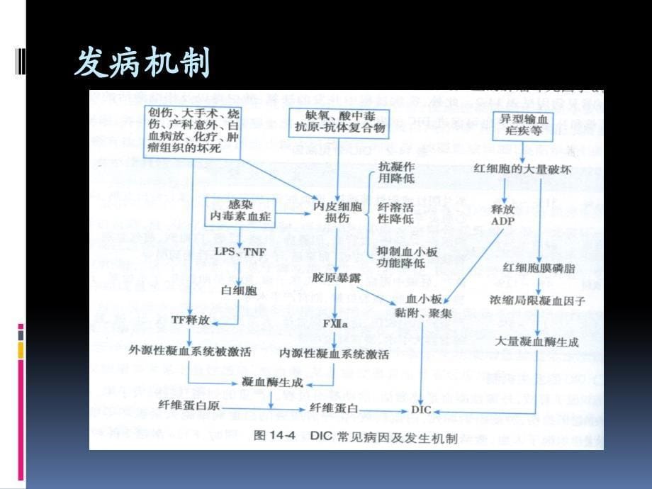 弥散性血管内凝血(DIC)_第5页