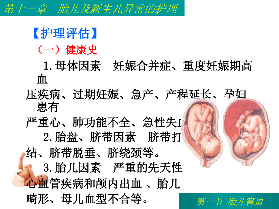 第十一章胎儿及新生儿异常的护理_第5页