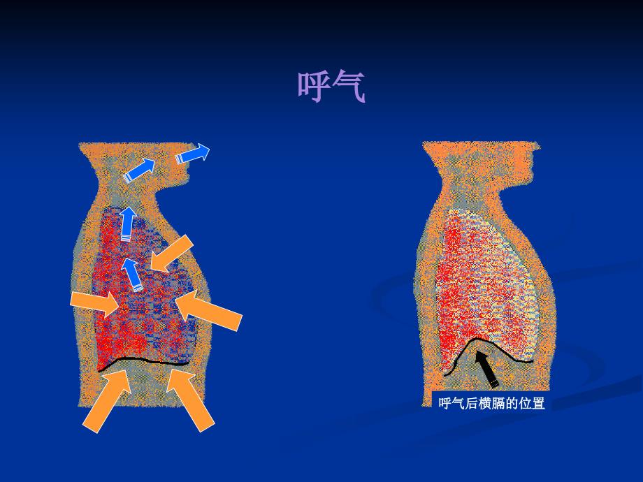 呼吸功能监测重症护理课件_第4页