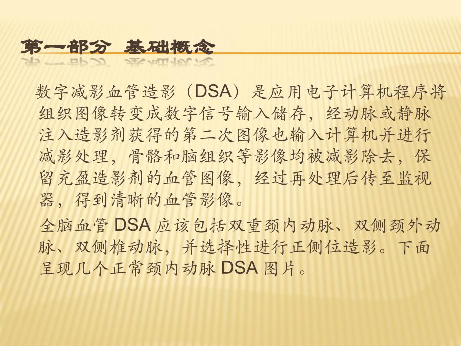 DSA全脑血管造影术PPT课件_第2页