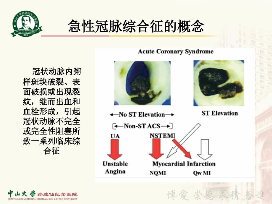 冠心病合并急性心律失常的紧急处理_第2页