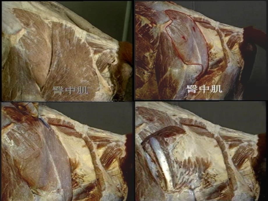 后肢、躯干、头部肌肉课件_第5页