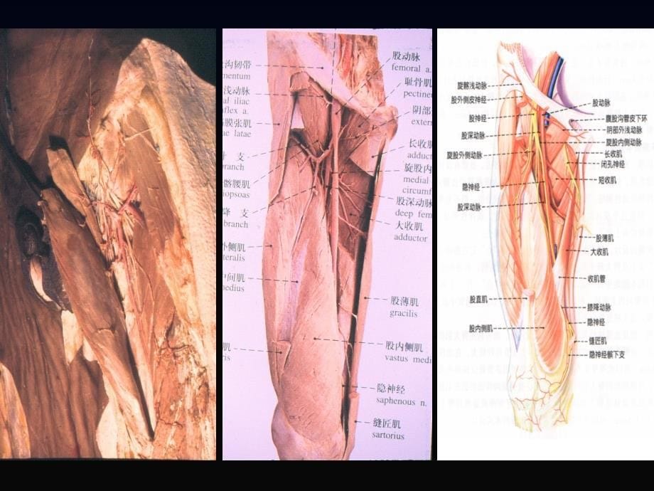 股前外侧皮瓣的解剖学研究与临床应用进展_第5页