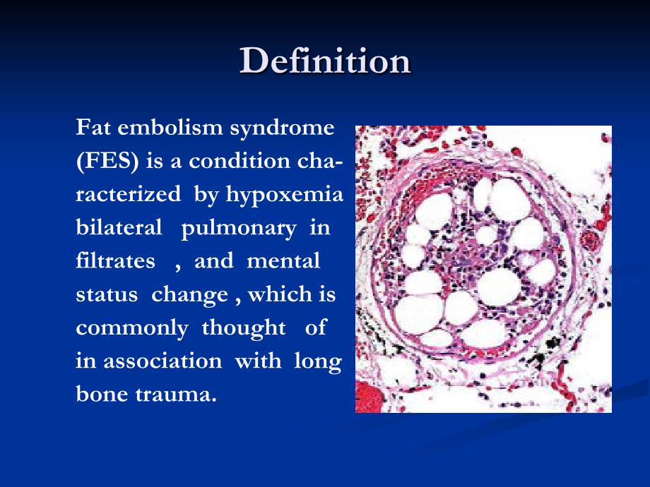 Fat Embolism Syndrome_第2页