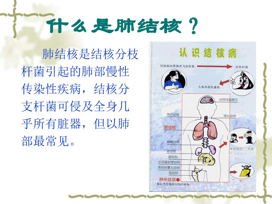 肺结核患者的护理查房_第4页