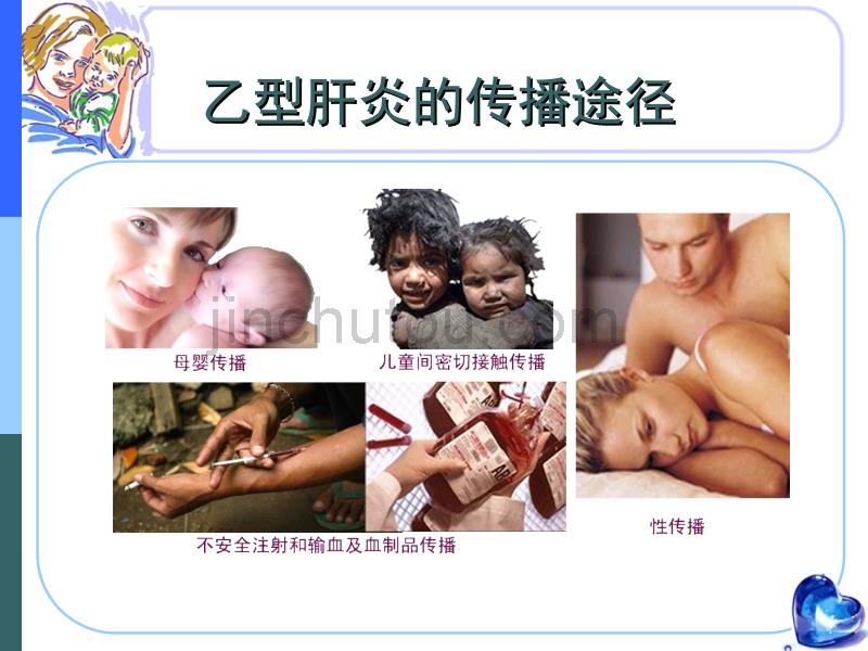 乙肝育龄妇女抗病毒策略及HBV母婴阻断_第2页