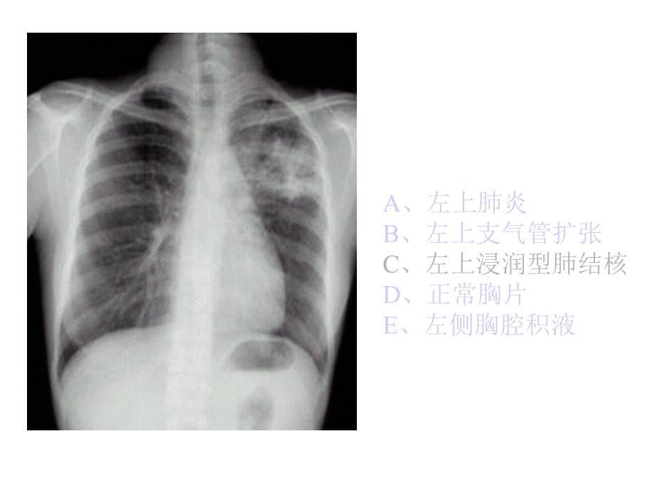 执业医师操作考试(X光片)_第2页