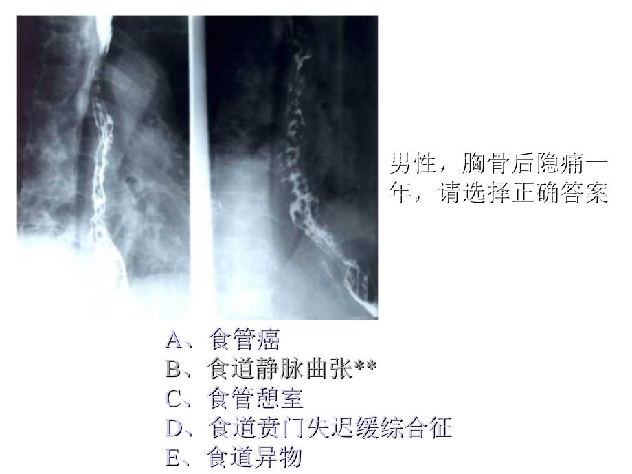 执业医师操作考试(X光片)_第3页