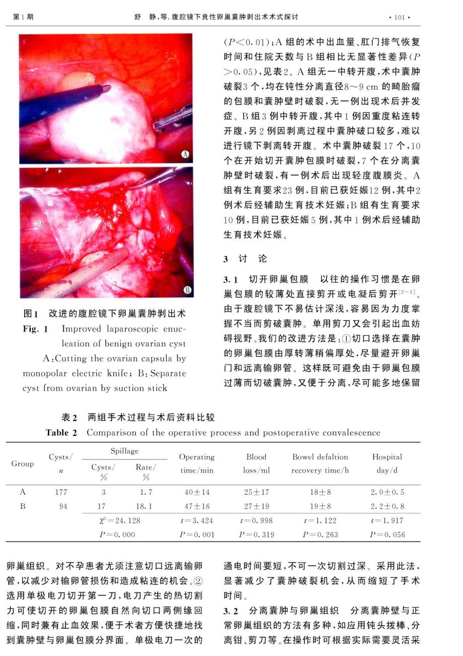 腹腔镜下良性卵巢囊肿剥出术术式探讨_第3页