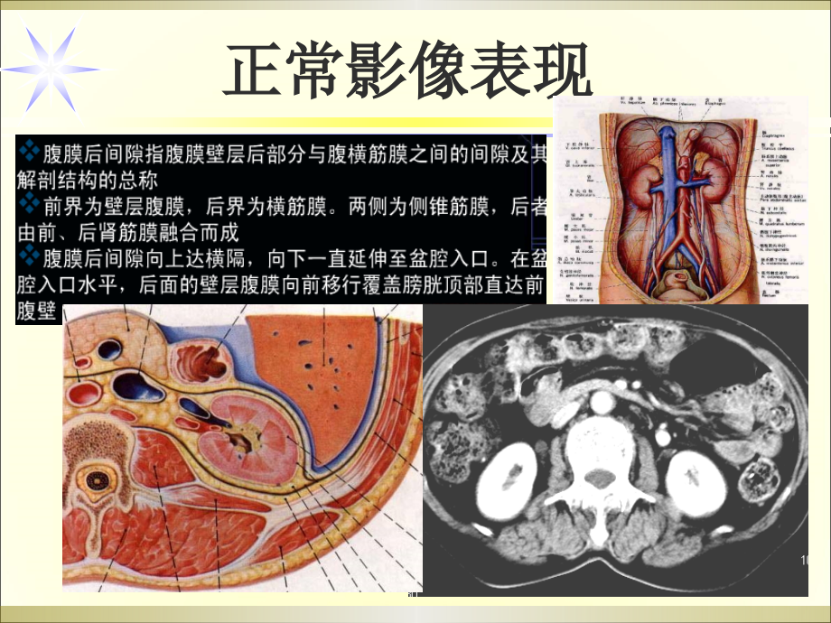 腹膜后间隙和泌尿生殖系统影像诊断_第2页