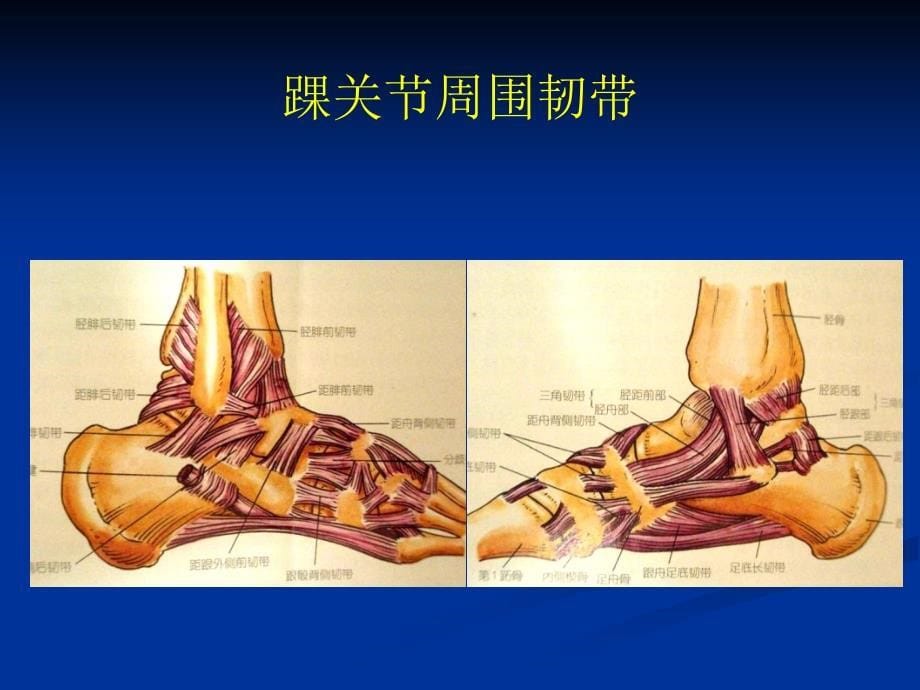 踝关节撞击综合征影像学_第5页