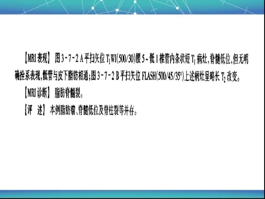 脊髓与脊柱病变mri诊断_第5页