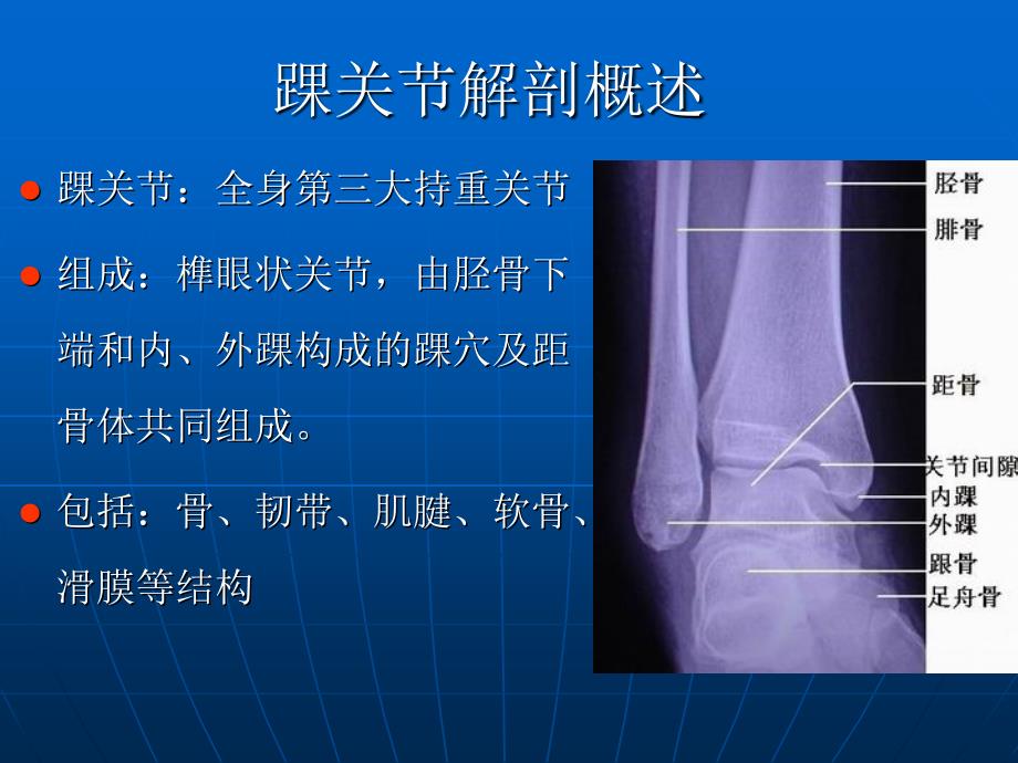 踝关节损伤磁共振诊断_第2页