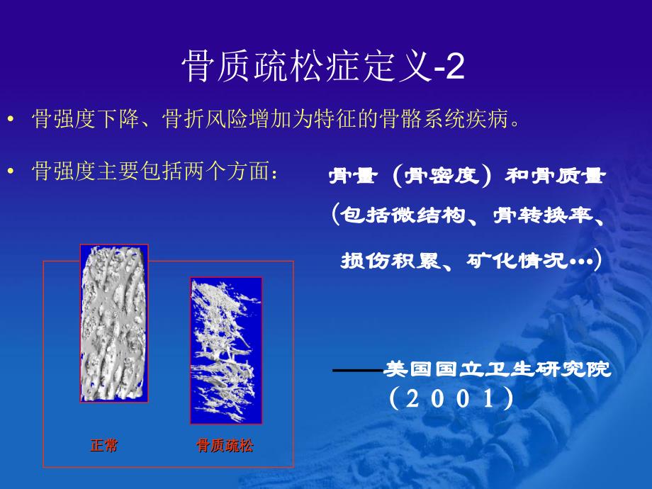 骨质疏松症诊断与治疗_第4页