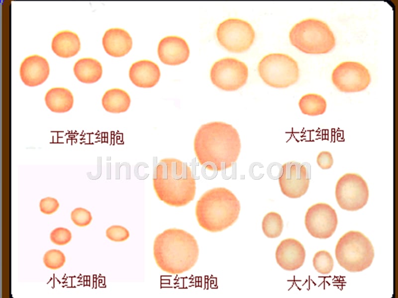 血细胞分析仪的检测技术及临床应用_第3页