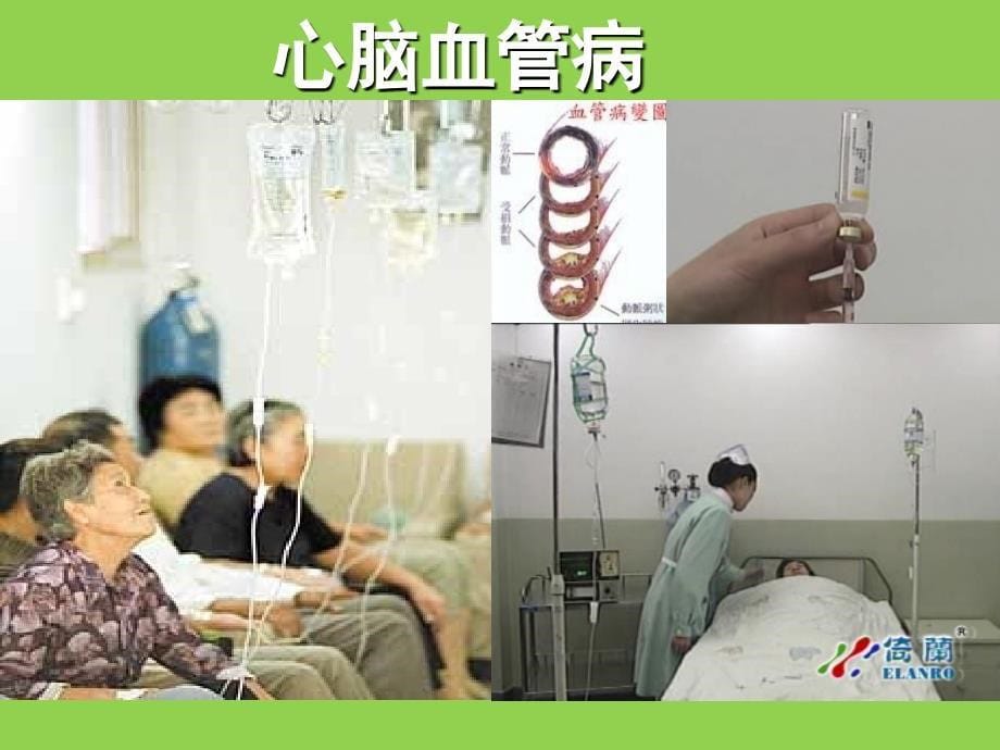 水与健康知识讲座PPT_第5页