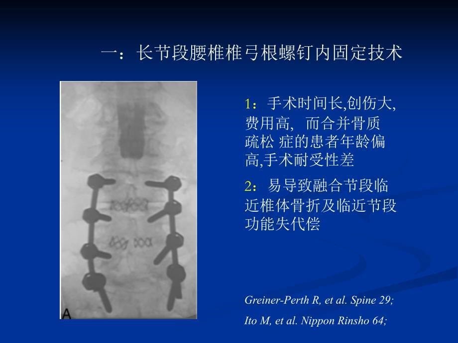 腰椎滑脱伴骨质疏松的手术治疗_第5页