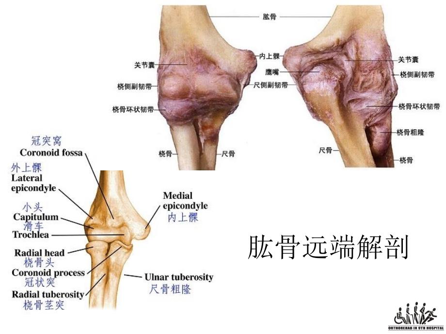 肘关节骨折康复治疗_第2页