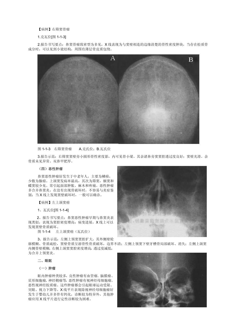 影像诊断要点及书写规范(x线)_第2页