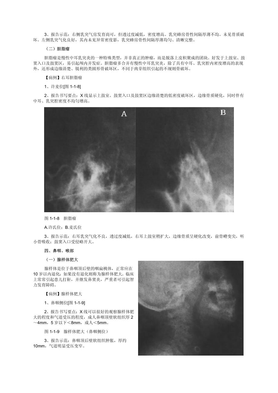 影像诊断要点及书写规范(x线)_第4页