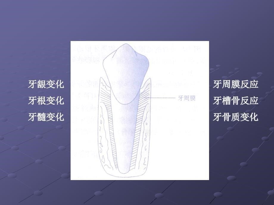 正畸治疗的生物机原理_第5页