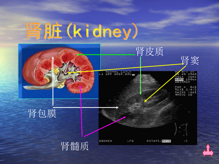 肾脏解剖肾积水肾囊肿的超声诊断学_第3页