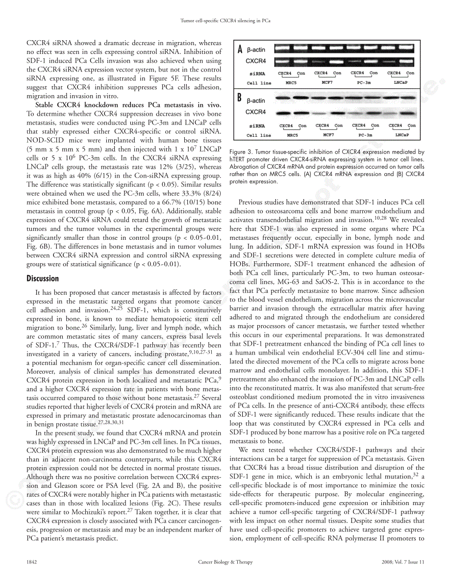 泌尿外科膀胱肿瘤_第4页