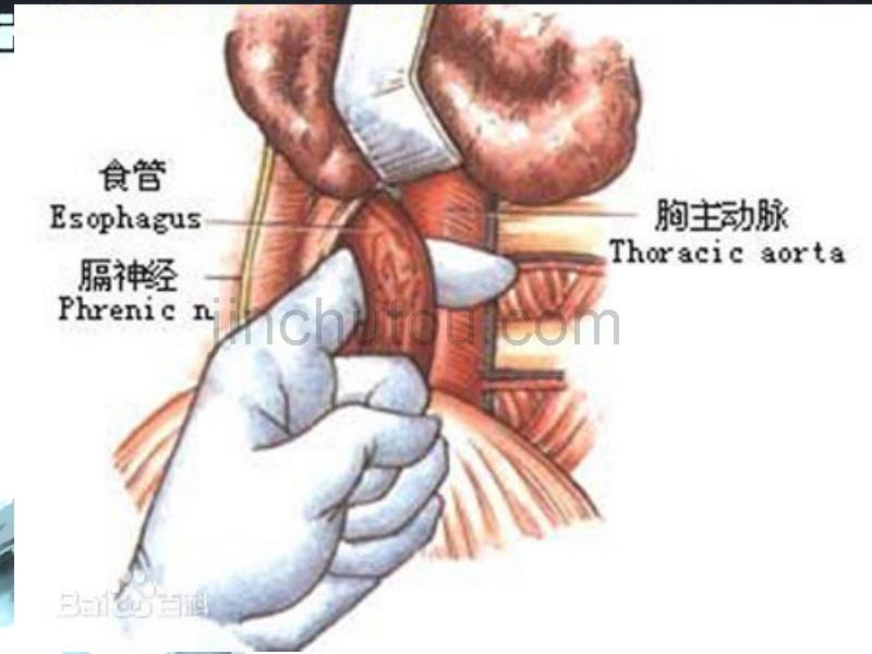 中医药膳制作_第5页