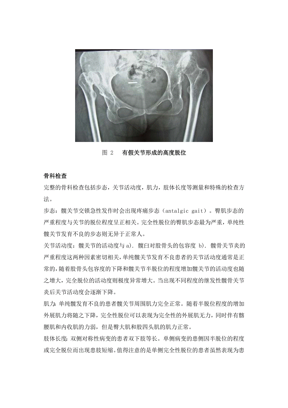 成人发育性髋关节发育不良与髋关节脱位.doc_第4页